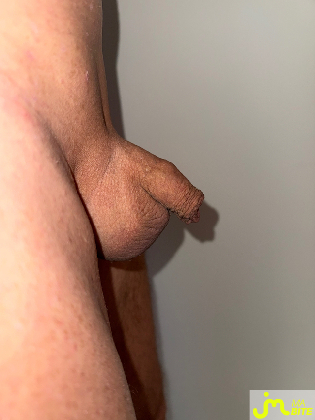 bites de Bisoumilisse