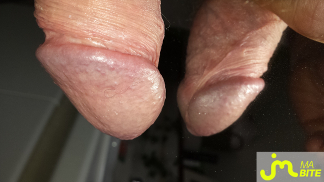 bites de close_up_zizi