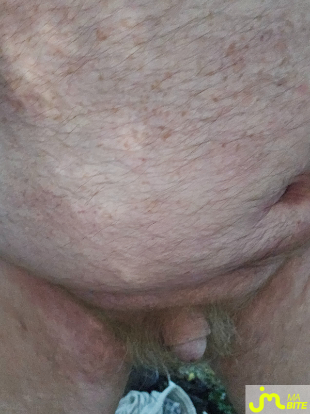 bites de Jean michel89