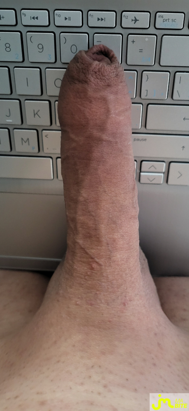 bites de Landa1 