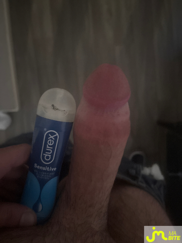 bites de Ziodinamite