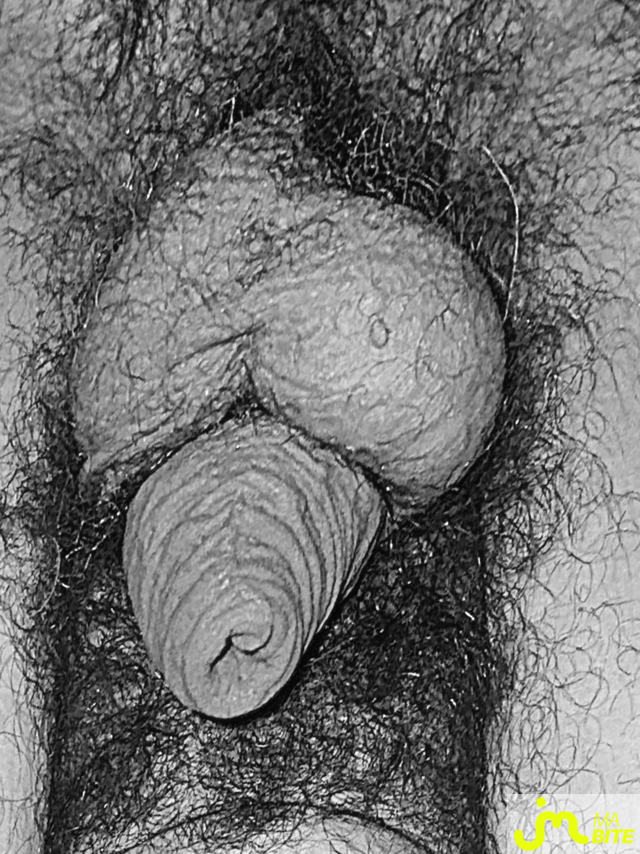 bites de Lesvieuxamants