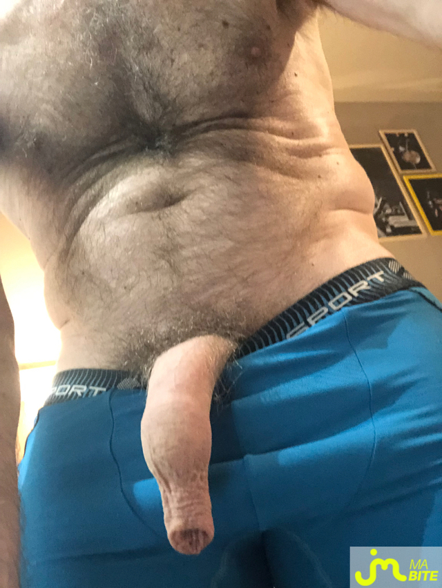 bites de longprepuce