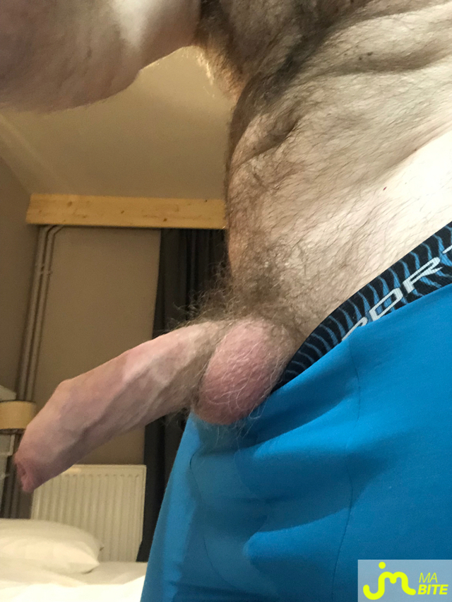 bites de longprepuce