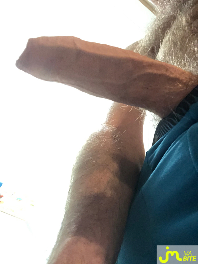 bites de longprepuce