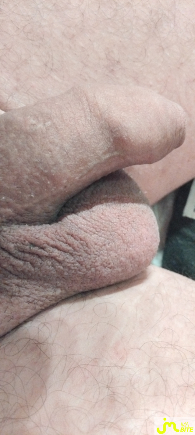 bites de Couple Calin