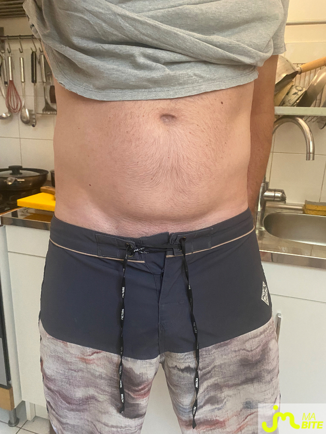 bites de Mabitegrosse