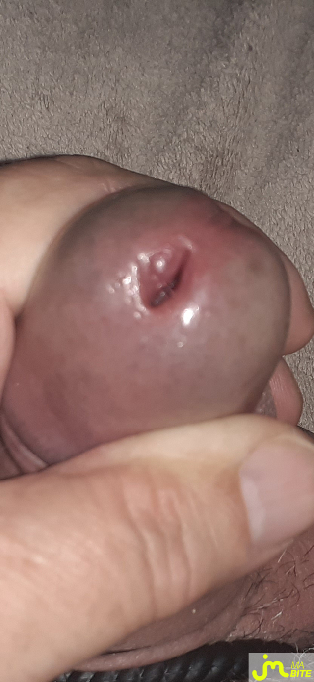 bites de denis 38000