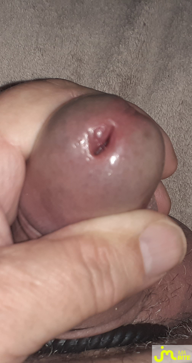 bites de denis 38000