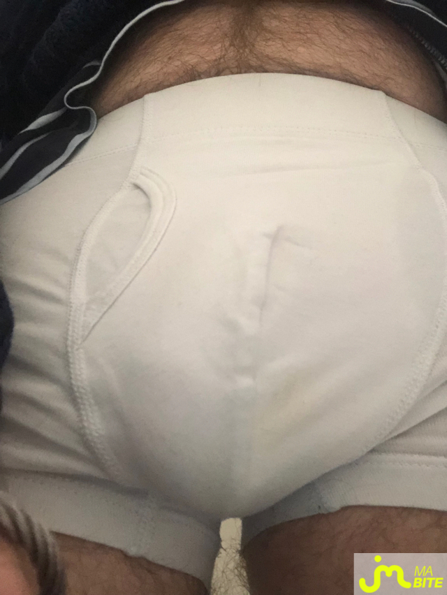 bites de longprepuce