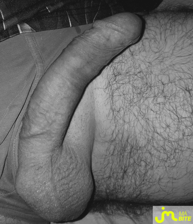 bites de Cocufieurjoe