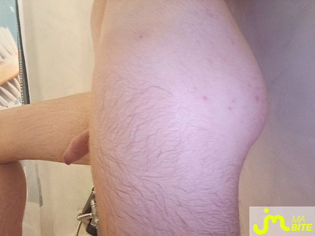 bites de Camerone6901