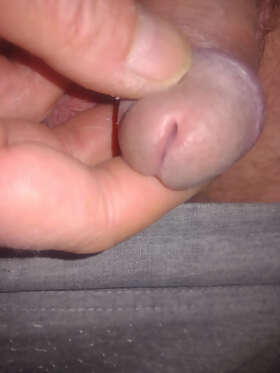 Photos de bites : Premier album 