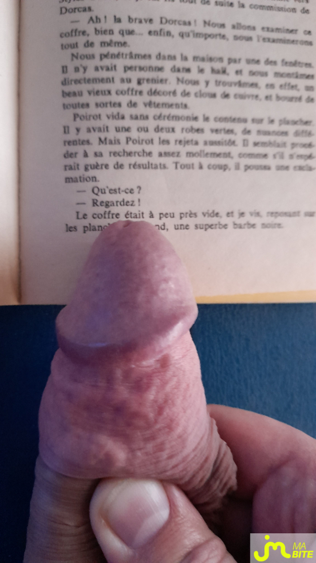 bites de HoverDaws2sex