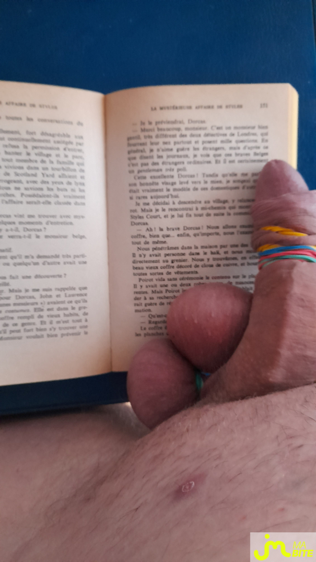 bites de HoverDaws2sex