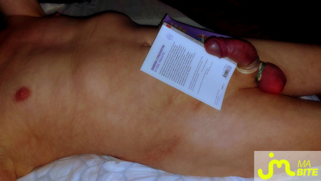 bites de Vxmâlebi46