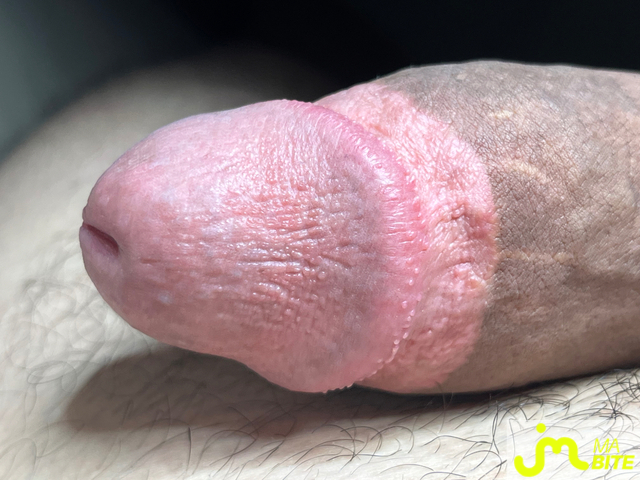 bites de Rebeusocquette 