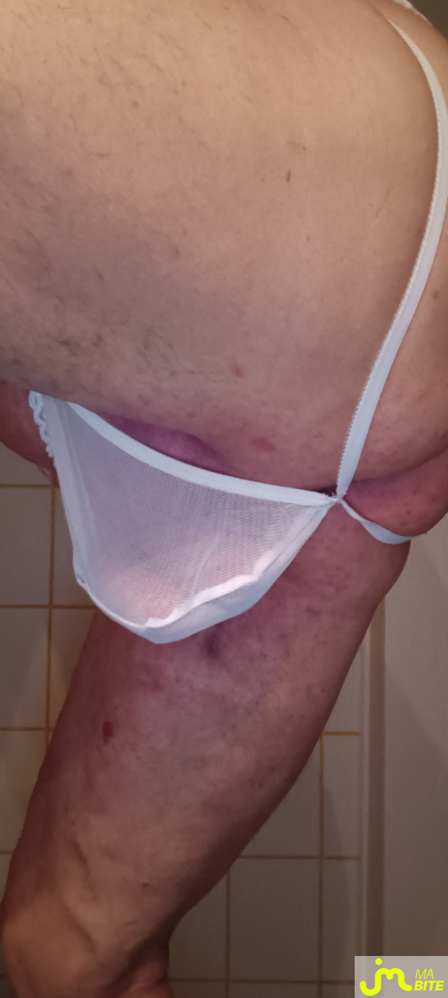 bites de Plastic 3157