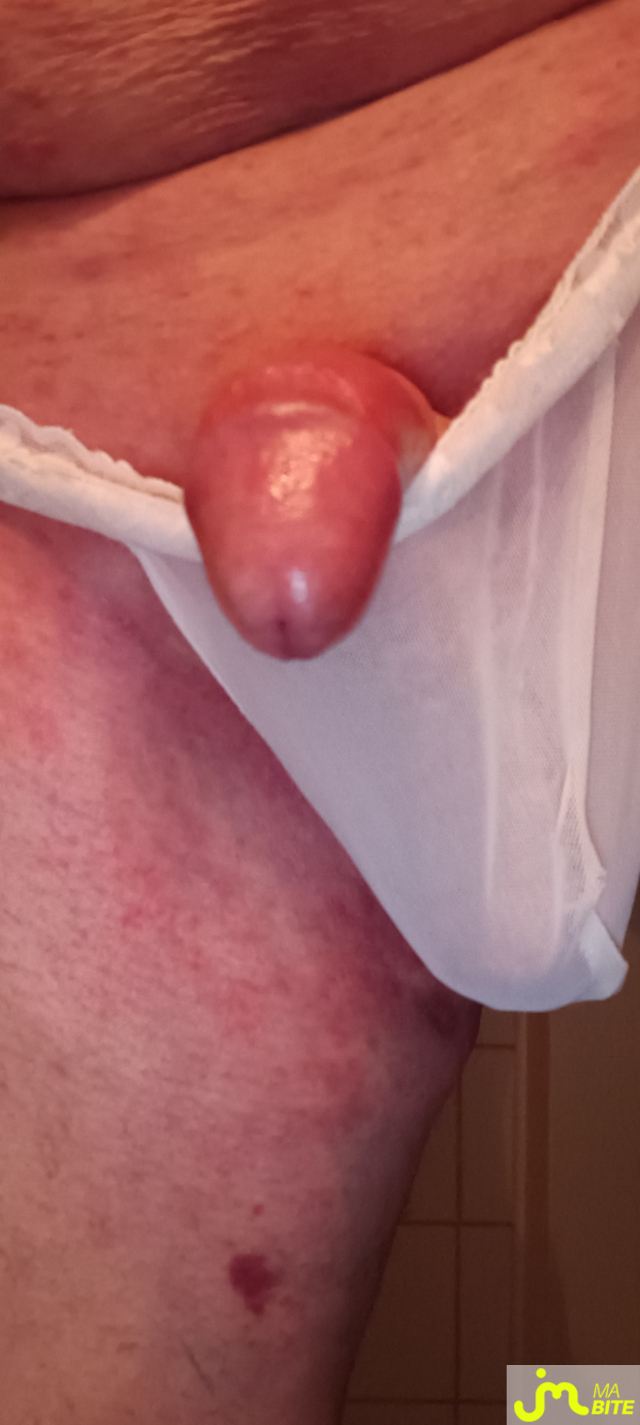 bites de Plastic 3157