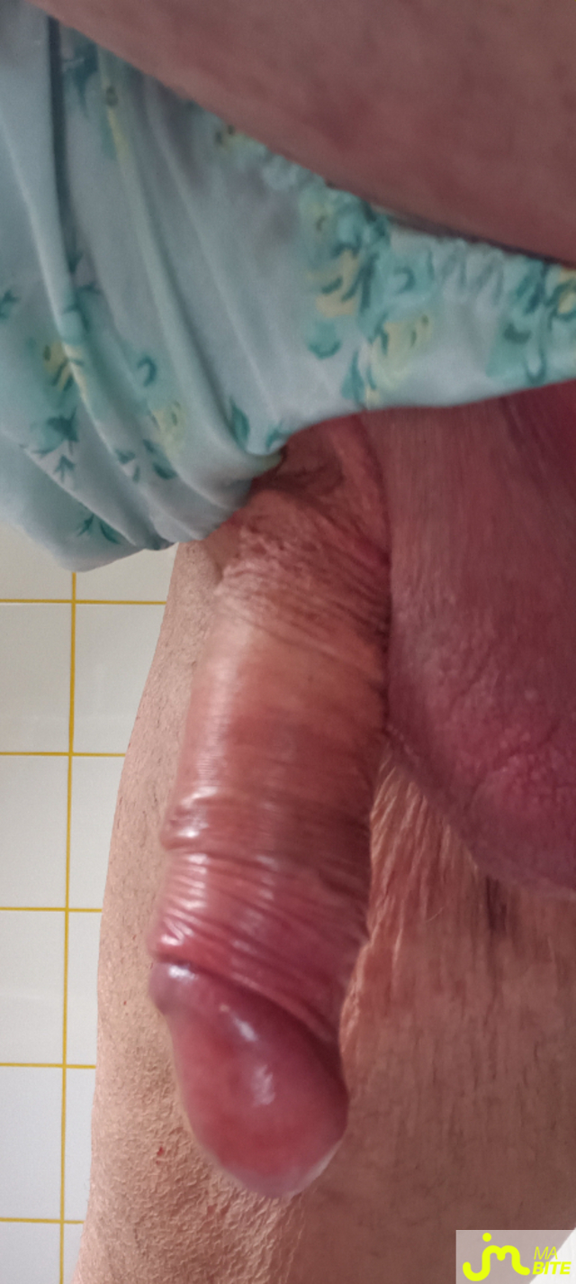 bites de Plastic 3157