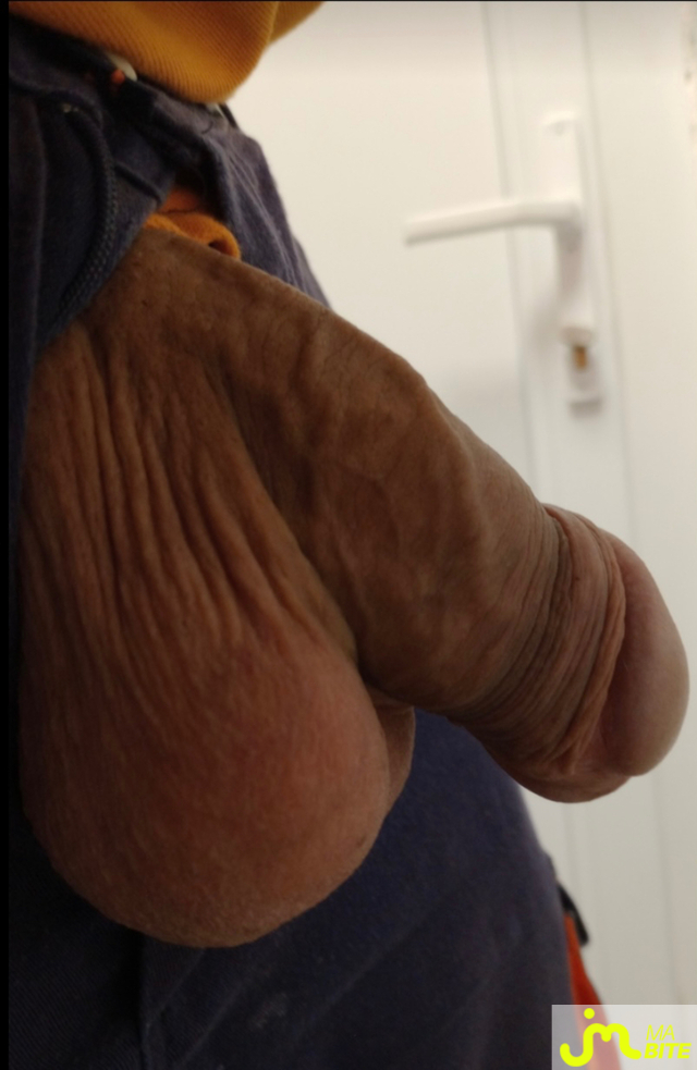 bites de Joker&Harley0608