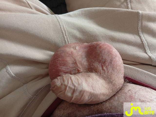 bites de Castration83