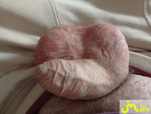bites de Castration83