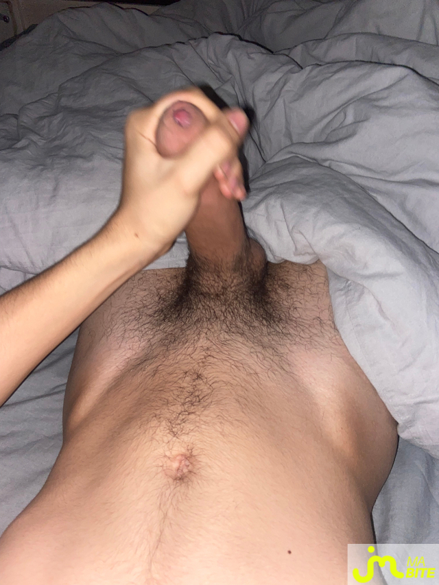 bites de labellegrossebite