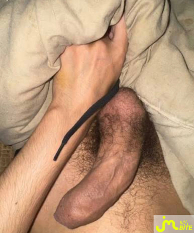 bites de Piter Lewis lattimer