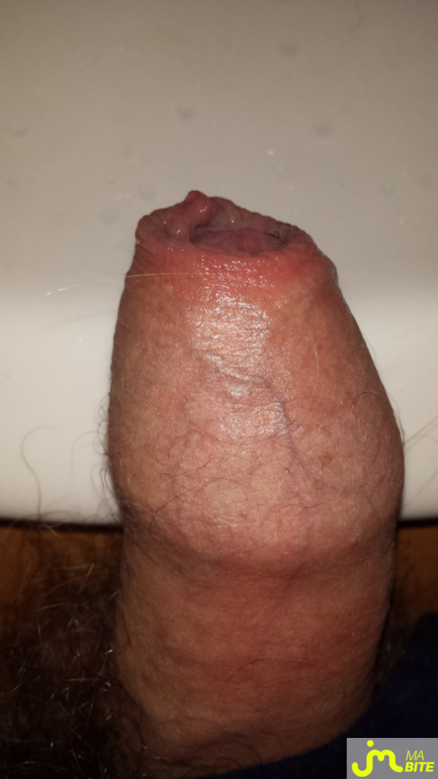 bites de close_up_zizi