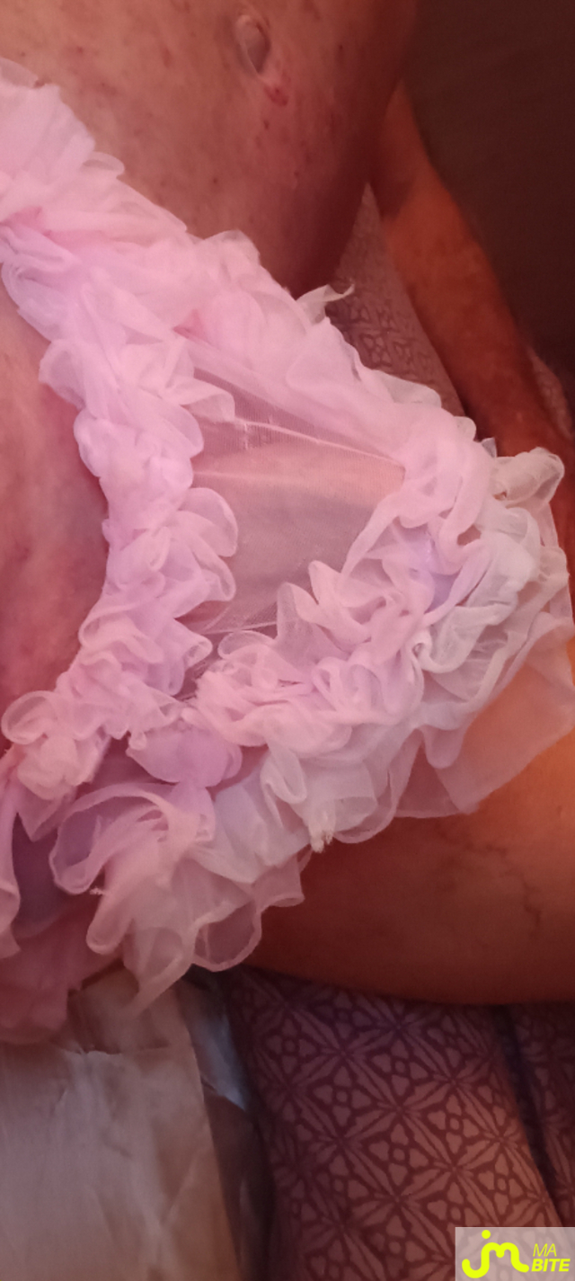 bites de Plastic 3157