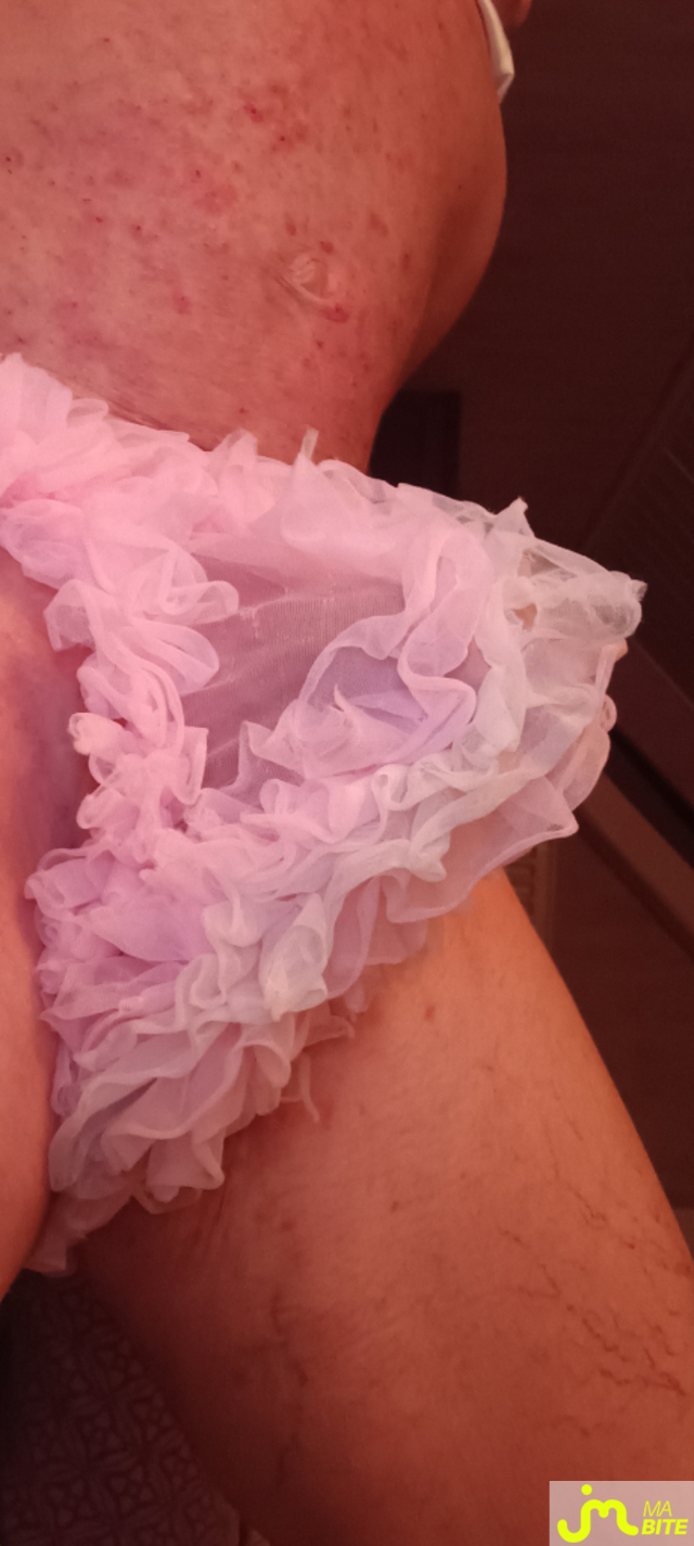 bites de Plastic 3157