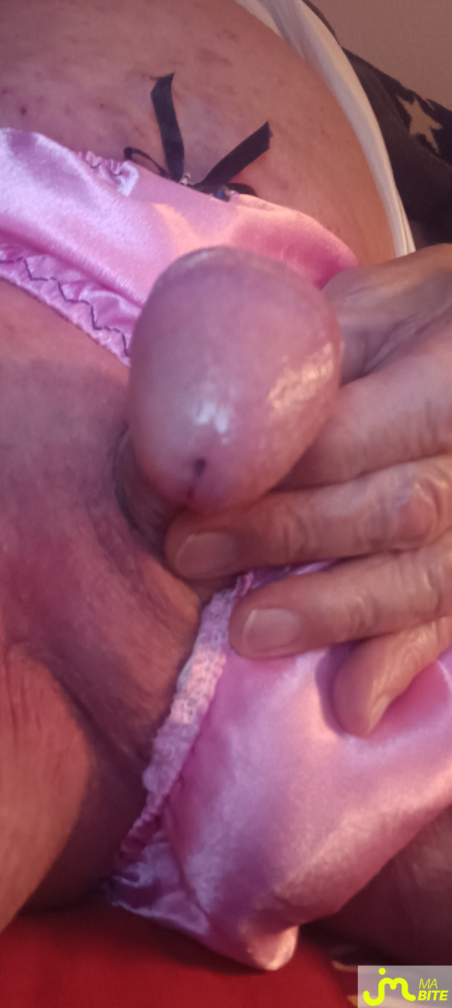 bites de Plastic 3157