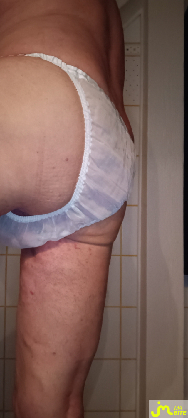 bites de Plastic 3157