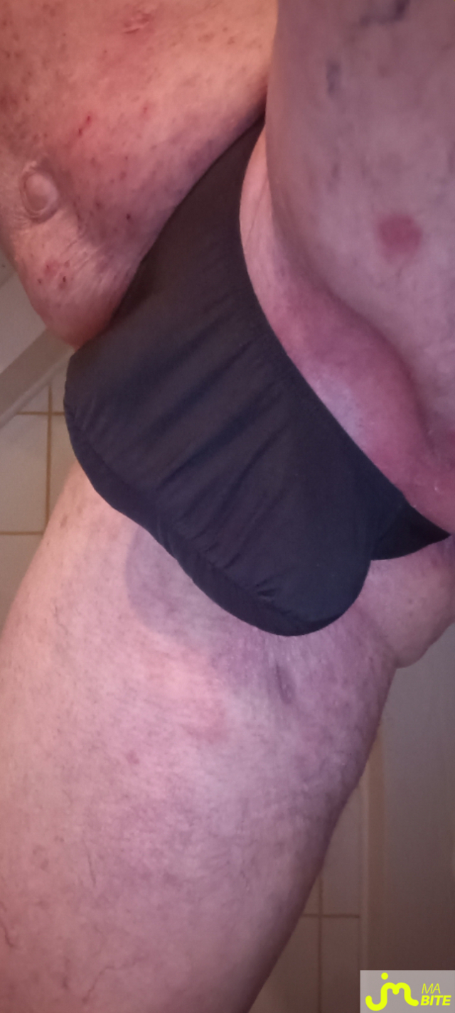 bites de Plastic 3157