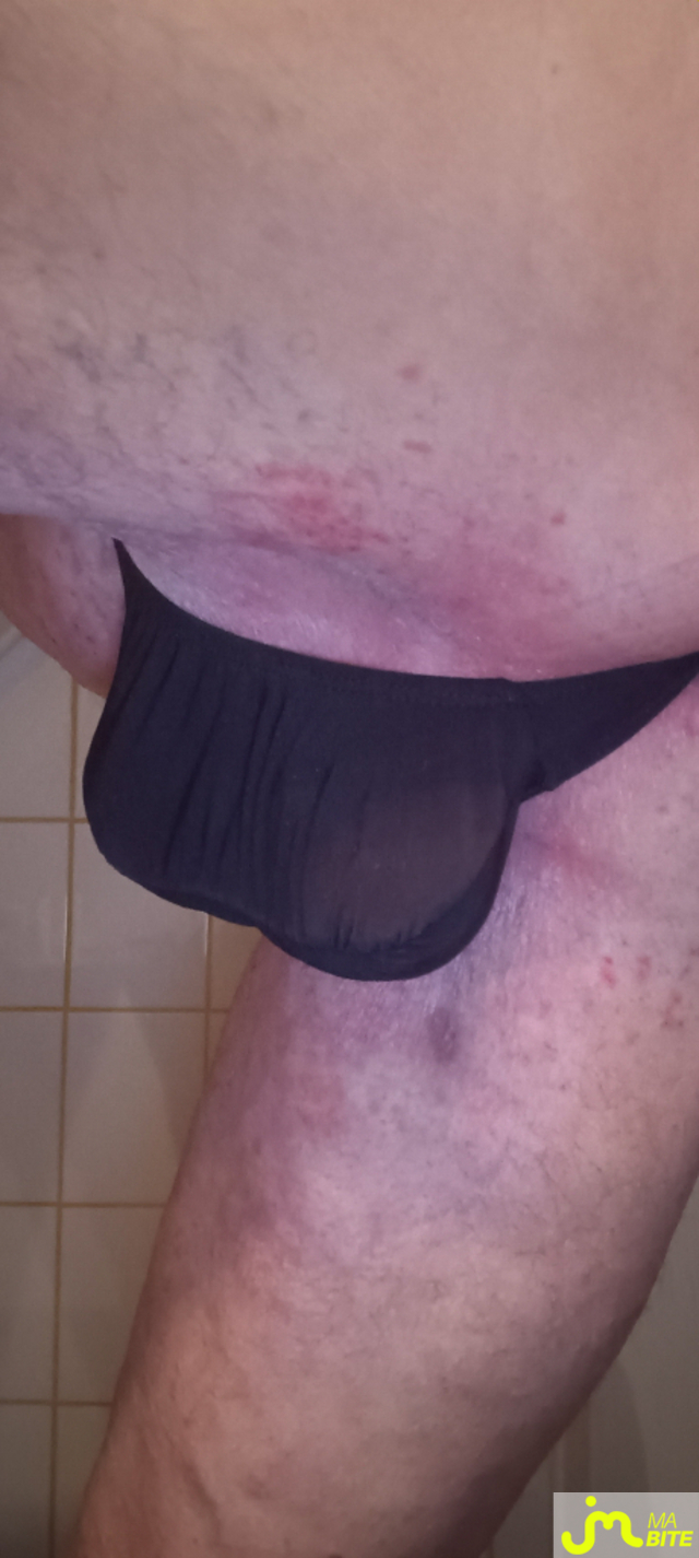 bites de Plastic 3157