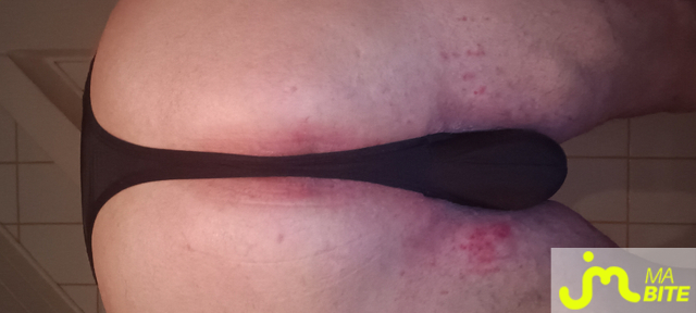 bites de Plastic 3157