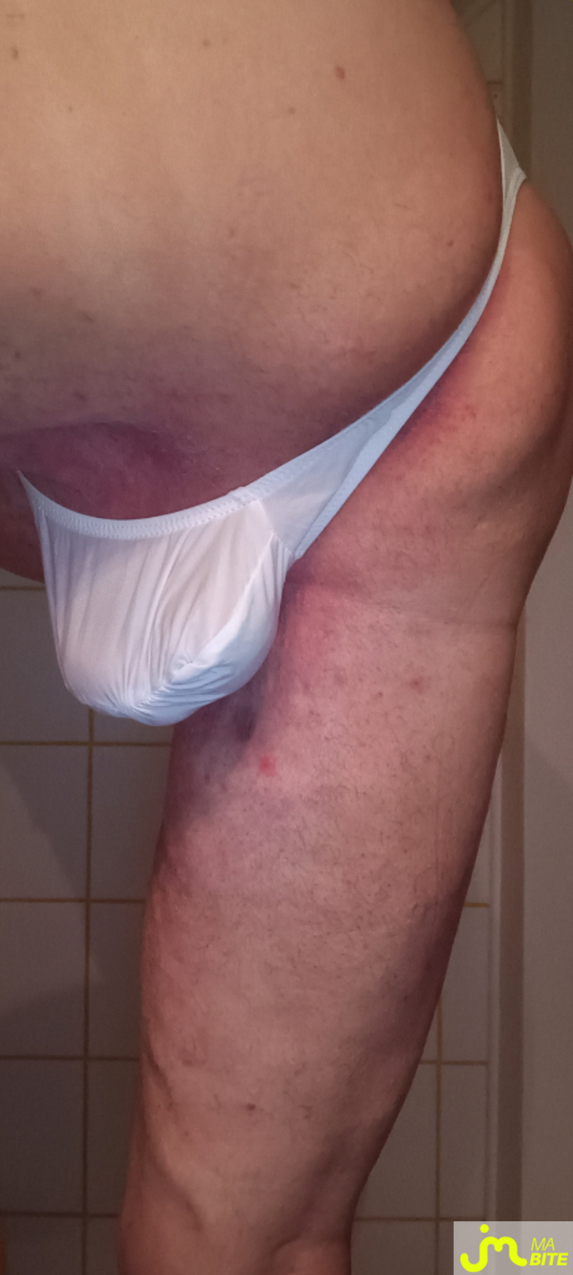 bites de Plastic 3157