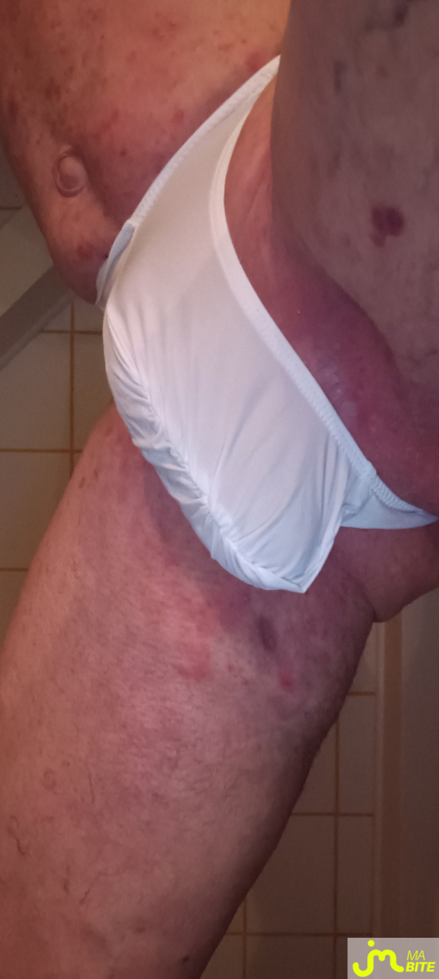 bites de Plastic 3157