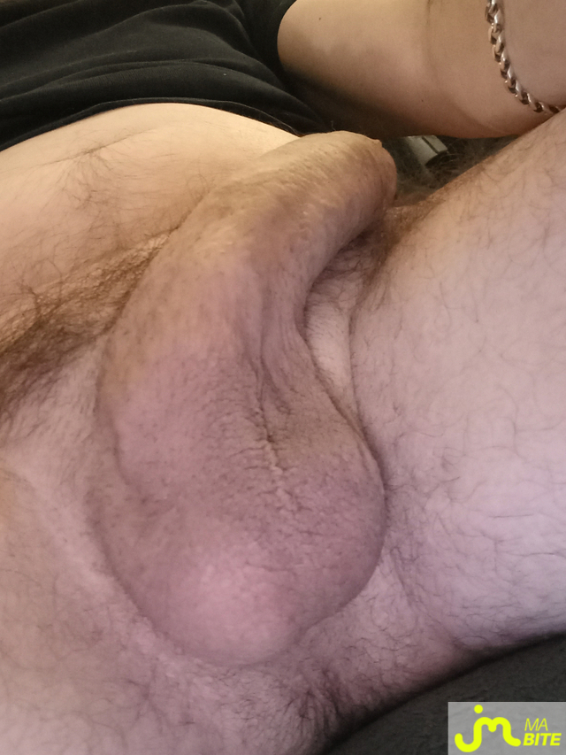 bites de wormsbuzhuc37