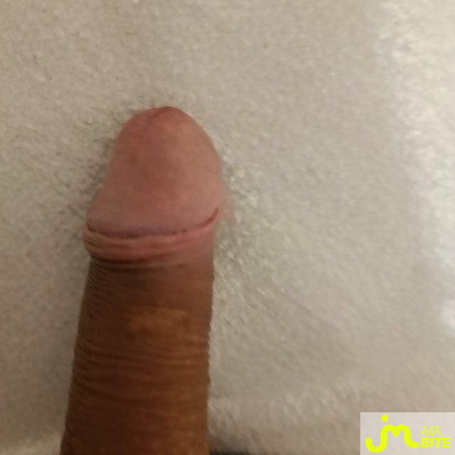 bites de Ragnard142776