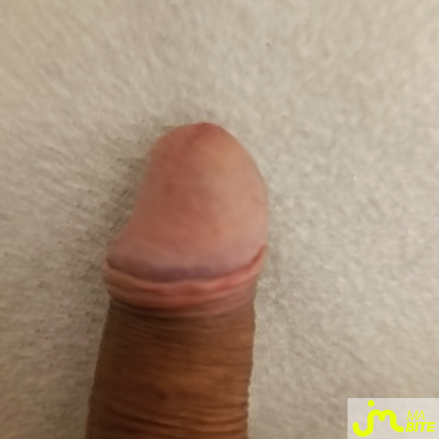 bites de Ragnard142776