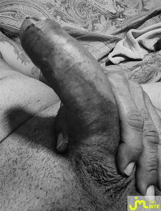 bites de L'antillais