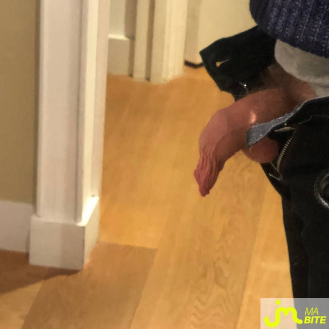 bites de longprepuce