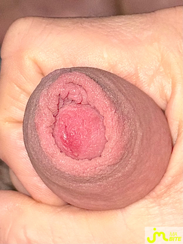 bites de Minicouilles