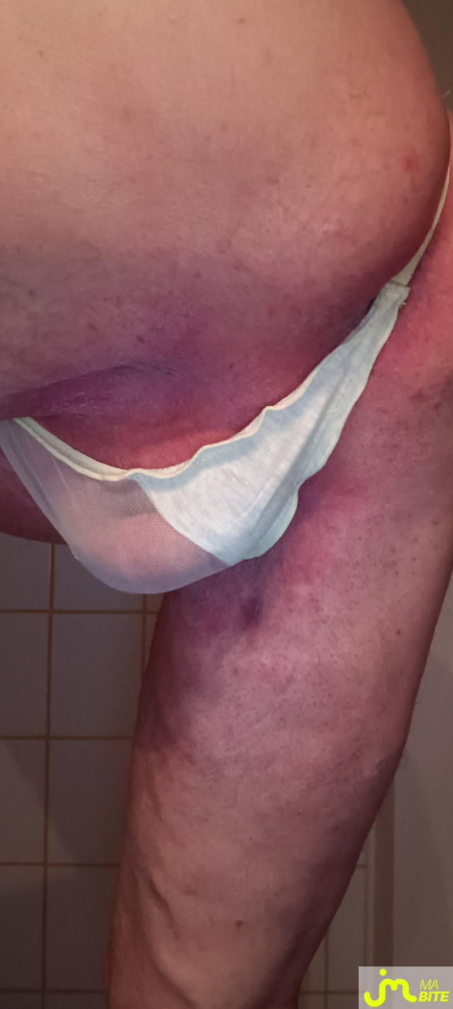 bites de Plastic 3157