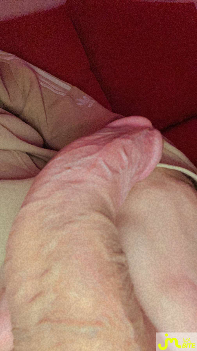 bites de Inconito9601