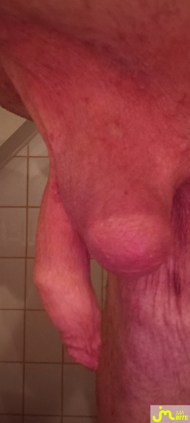 bites de Plastic 3157