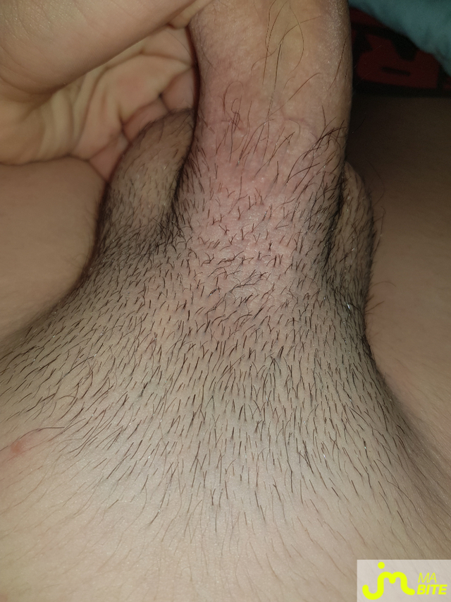 bites de Anonyme0273628