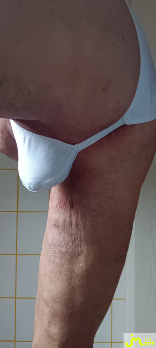 bites de Plastic 3157